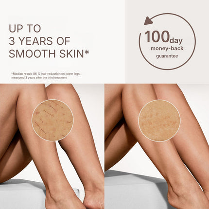 Philips Lumea IPL 7000 Series SenseIQ Hair Removal, Body Attachment, Pearl Peach